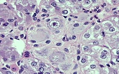 Histological section showing sympathetic ganglion cells