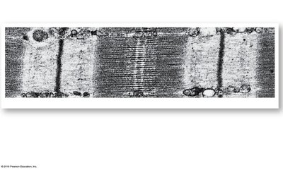 Electron micrograph of sarcomere structure