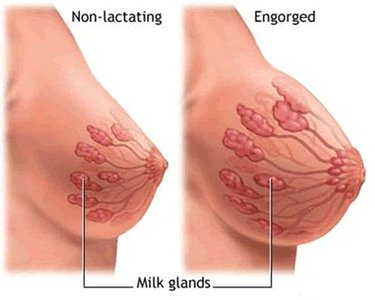 Non-lactating vs. engorged mammary glands