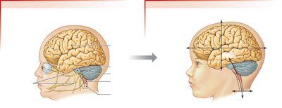 Cerebrum growth and brain orientation at birth