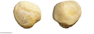 Patella, anterior and posterior surfaces