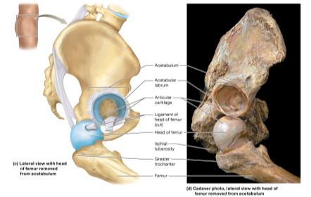 Anatomical structure of the hip joint (lateral and cadaver views)
