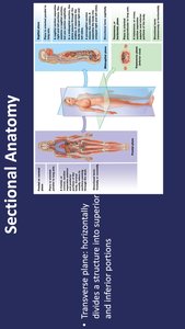 Sectional anatomy: transverse plane