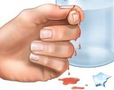 Tissue injury and healing