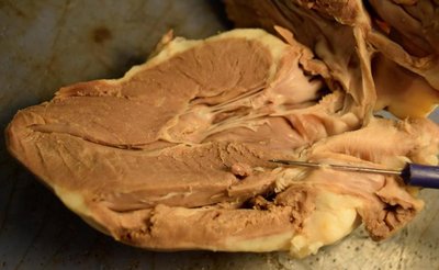 Endocardium of the heart