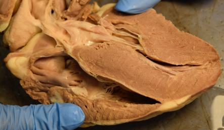 Bicuspid/Mitral and Tricuspid valves
