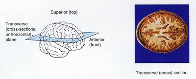 Transverse section of the brain