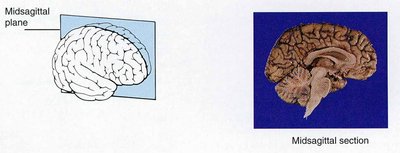 Midsagittal section of the brain