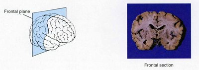 Frontal section of the brain