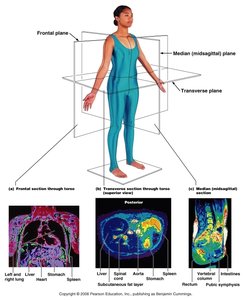 Body planes with MRI images