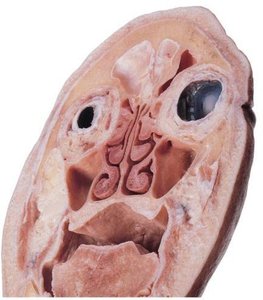 Transverse section of nasal cavity