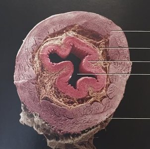 Cross-section of the GI tract showing mucosa, submucosa, muscularis, and serosa