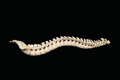 Lateral view of the vertebral column with regions color-coded