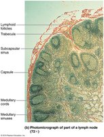Photomicrograph of a lymph node