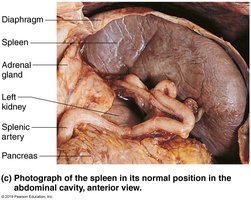 Photograph of the spleen in the abdominal cavity