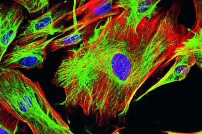 Fluorescence microscopy of cells