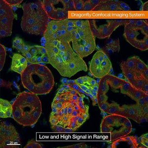 Confocal microscopy of tissue