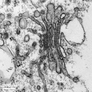 TEM image of cell structures
