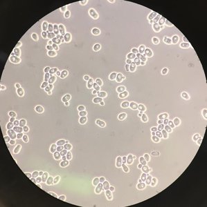 Dark-field microscopy of yeast cells