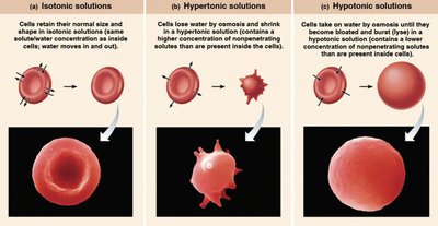 Tonicity: isotonic, hypertonic, hypotonic