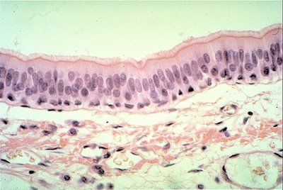 Pseudostratified ciliated columnar epithelium