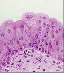 Transitional epithelium