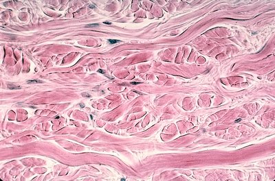 Dense irregular connective tissue