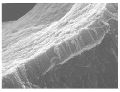 Microvilli on epithelial cells