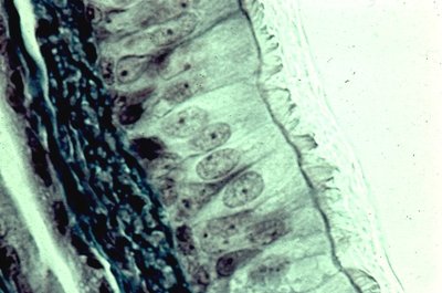 Cilia on epithelial cells
