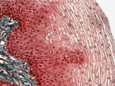 Stratified squamous epithelium