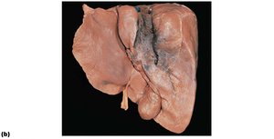 Gross anatomy of the human liver