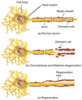 Stages of neuron regeneration: chromatolysis, Wallerian degeneration, regeneration tube