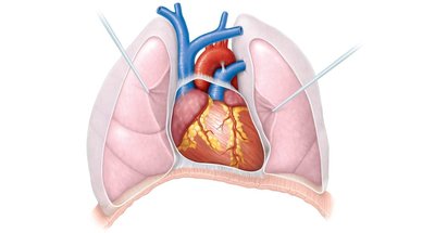 Diagram showing the location of the heart within the thorax