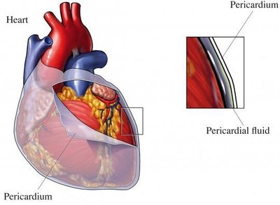 Heart with pericardium and pericardial fluid