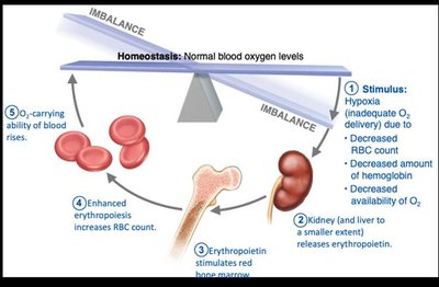 Sickled erythrocyte due to amino acid change in hemoglobin