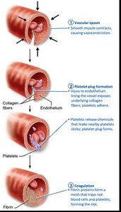 Agglutination reaction: RBCs and antibodies