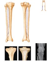 Posterior view, proximal tibia