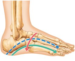 Arches of the foot, lateral aspect