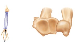 Distal ends of the radius and ulna at the wrist