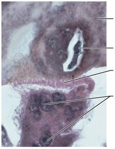 Osteoclast structure