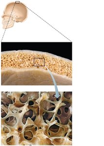 Spongy bone structure