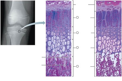 Growth in length of a long bone at the epiphyseal plate