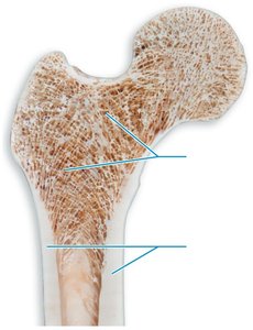 Compact and spongy bone