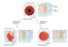 Effects of isotonic, hypertonic, and hypotonic solutions on cells