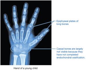 Epiphyseal plates in child's hand