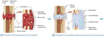 Process of fracture repair
