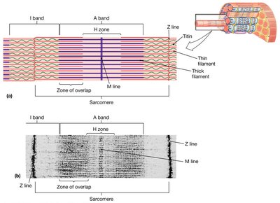 Sarcomere with A band, H zone, and I band