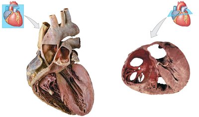 Sectional anatomy of the heart showing internal features and valves.