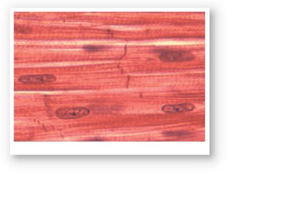 Histological view of cardiac muscle tissue.