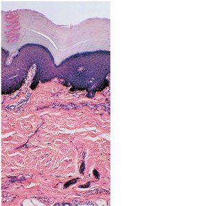 Light micrograph of the two layers of the dermis